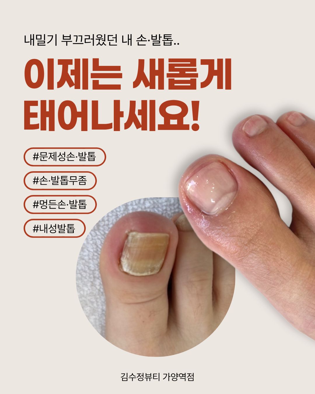 캠페인이미지